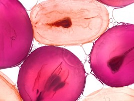 Ресвератрол: почему этот ингредиент находится в центре внимания