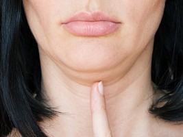 Как избавиться от двойного подбородка: 7 эффективных способов