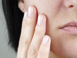 Почему весной «расцветают» поры и как взять ситуацию под контроль 