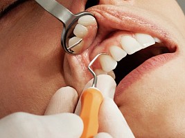 Оголенные корни зубов: причины рецессии десны, симптомы и лечение