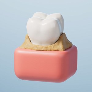 Невидимый враг улыбки: почему зубной камень старит лицо и запускает кариес