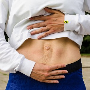 Диастаз после родов: оперировать или нет?