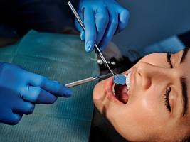 Что вы стеснялись спросить: 10 неудобных вопросов стоматологу