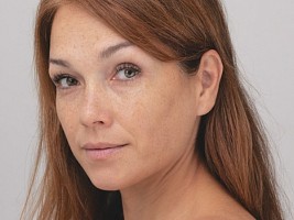 Взгляд после сорокá: как меняются веки и что можно сделать для сохранения молодости 