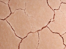 Все сохнет: 8 продуктов, которые помогают увлажнить кожу в отопительный сезон