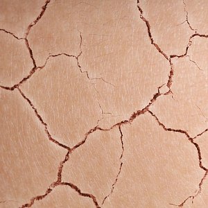 Все сохнет: 8 продуктов, которые помогают увлажнить кожу в отопительный сезон
