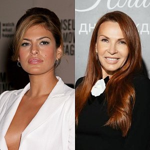 Ева Мендес, Хлои Кардашьян, Эвелина Бледанс: кто из звезд сделал нитевой лифтинг