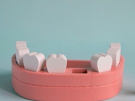 Пустое место: почему отсутствие зуба — это реальная угроза здоровью