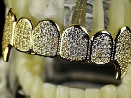 Бриллиантовая улыбка: кто из знаменитостей носит на зубах целое состояние