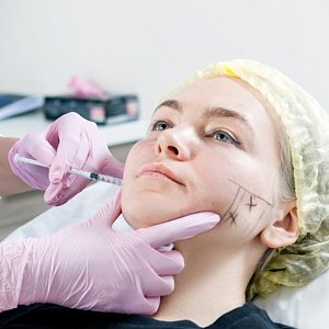 Ботокс в жевательные мышцы: полный гид по процедуре Ботокс в жевательные мышцы: полный гид по процедуре