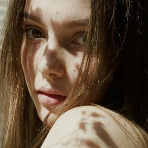 Пигмент на коже, который остался после лета: как с ним бороться? Пигмент на коже, который остался после лета: как с ним бороться?