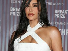 «Может привести к инсульту»: у Ким Кардашьян диагностировали аневризму головного мозга «Может привести к инсульту»: у Ким Кардашьян диагностировали аневризму головного мозга