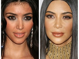 «У меня самый волосатый лоб»: Ким Кардашьян не скрывает, что удаляла растительность с лица