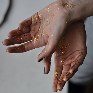 Не к деньгам: что не так с организмом, когда чешутся ладони Не к деньгам: что не так с организмом, когда чешутся ладони