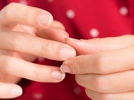 Питтинг ногтей: почему появляются ямки на ногтевой пластине и как их выровнять