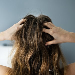 Почему чешется кожа головы: 12 причин и что с этим делать