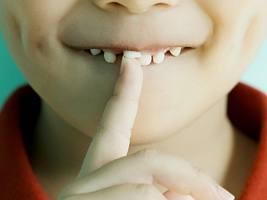 Зуб – не аксессуар: почему нужно следить за здоровьем не только постоянных, но и молочных зубов 