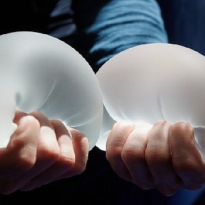8 опасных последствий маммопластики 8 опасных последствий маммопластики