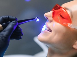 Материалы для пломб: что сейчас используют стоматологи, а что уже устарело 