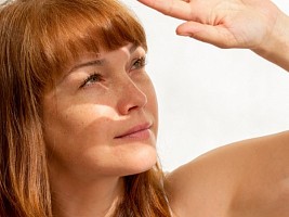 Темная история: как избавиться от пигментации
